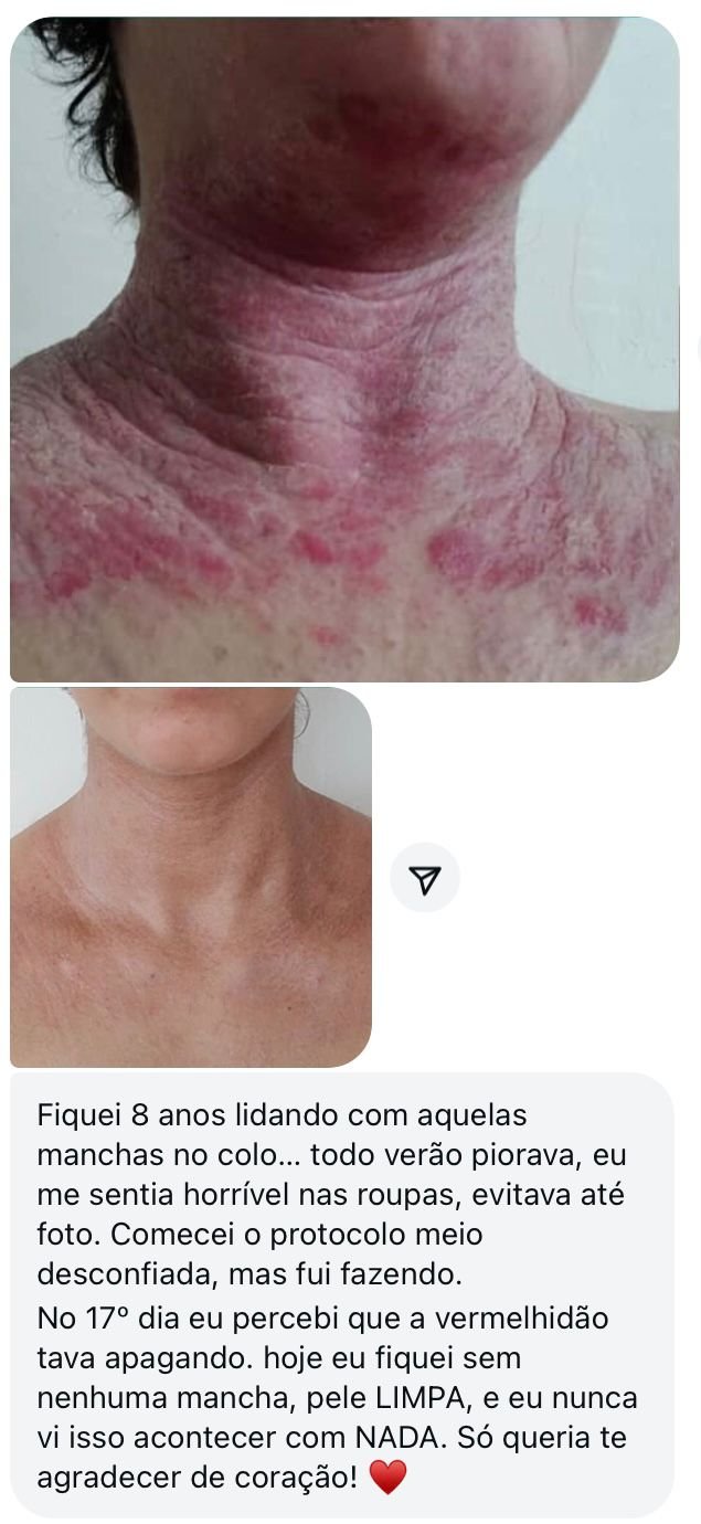 Depoimento sobre erupções cutâneas